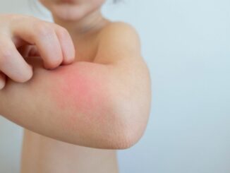 Parasitäre Erkrankungen bei Kindern: Krätze und Läuse